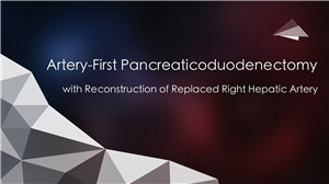 动脉入路胰十二指肠切除术+异位肝右动脉重建　<sup><span style=color:#ff0000;><strong>一等奖</strong></span></sup>