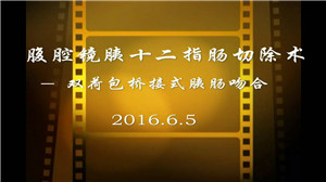 腹腔镜胰十二指肠切除术——双荷包桥接式胰肠吻合