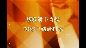 腹腔镜下胃癌D2淋巴结清扫术