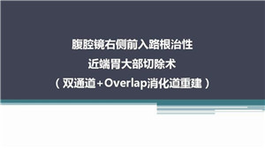 腹腔镜下右侧前入路根治性近端胃大部切除术（双通道+Overlap消化道重建）