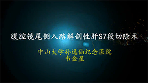腹腔镜尾侧入路解剖性肝S7段切除术