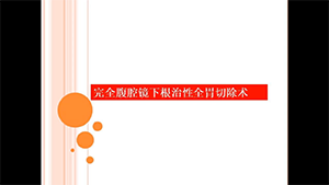 腹腔镜下根治性全胃切除术（overlap吻合）