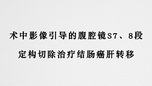 术中影像引导的肝S7、8段定构切除治疗结肠癌肝转移