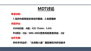 “头背侧”入路中肝静脉优先腹腔镜左半肝切除术