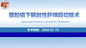 腹腔镜下解剖性肝Ⅷ段切除术