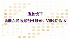 腹腔镜下循肝右静脉解剖性肝Ⅵ、ⅦI段切除术