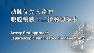 动脉优先入路的腹腔镜胰十二指肠切除术