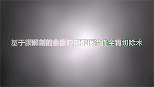 全腹腔镜下根治性全胃切除术