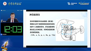 腹腔镜下IIIa型肝门部胆管癌根治术
