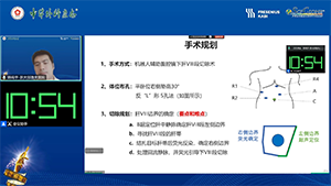 机器人辅助肝VIII段切除术