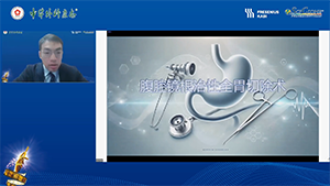 腹腔镜全胃切除