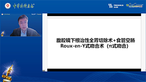腹腔镜下根治性全胃切除+食管空肠Rou-en-Y吻合 （π式）