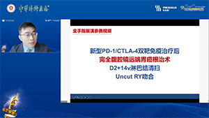 新型PD-1/CTLA-4双靶免疫治疗后完全腹腔镜远端胃癌根治术