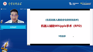 机器人辅助whipple手术（右后动脉入路结合勾突优先技术）