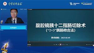 腹腔镜胰十二指肠切除术（“2+3”胰肠吻合法）