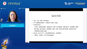 局部进展期胰腺癌的综合诊治